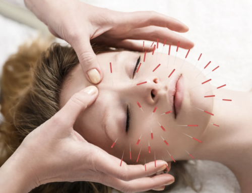 Some Benefits of Acupuncture